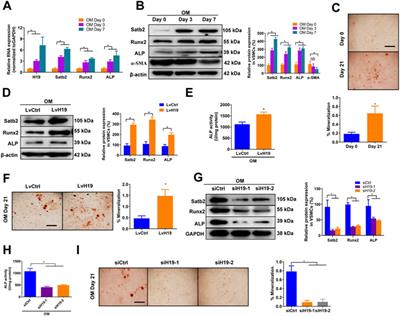 H19 Promotes Osteoblastic Transition by Acting as ceRNA of miR-140-5p in Vascular Smooth Muscle Cells